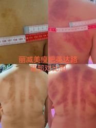 -丽减美瘦吧·减肥瘦身