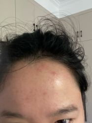 -Yestar重庆艺星医疗美容医院