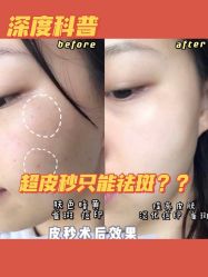 -丽美妍医疗美容·皮秒·立体分层抗衰