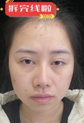 -素美医疗美容·西南眼鼻整形·修复基地
