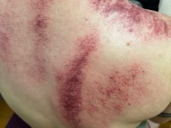 -沈师傅盲人按摩工作室(密三小区店)