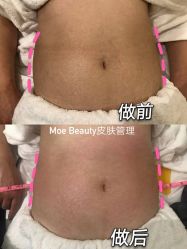 -MOE BEAUTY.皮肤管理中心