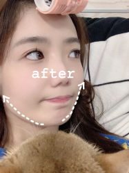 -agge蛋白医美
