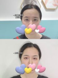 -久匠半永久纹眉