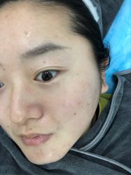 体验后-澳尔颜选医疗美容