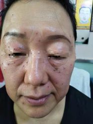 -北京美痣堂古方祛痣斑疣瘊
