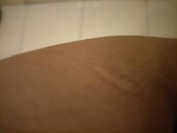 -成都军建医院·疤痕诊疗中心