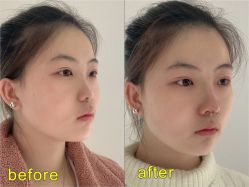 -深圳阳光医疗美容医院·旗舰店