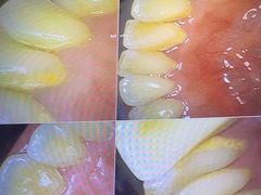 -土豆口腔(凤凰北总店)