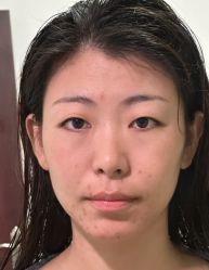 -石家庄苏亚美联臣医疗美容医院