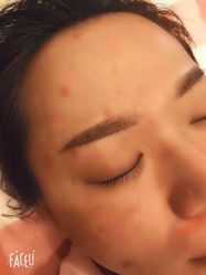 -郡艺医疗美容·微整·眼鼻吸脂