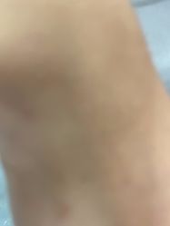 -美瑞莎创美医疗美容