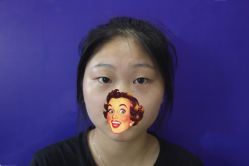 -成都西区医院整形美容