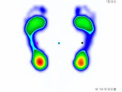 -Andrew指甲专科灰指甲·甲沟炎矫正·3D步态矫形鞋垫定制(上海法华镇路旗舰店)