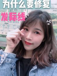 -大麦微针植发全国连锁