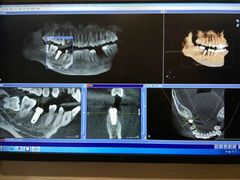 -耀光牙科(南园店)