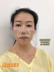 -广州美莱医疗美容医院