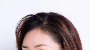 -大麦微针植发丨全国连锁