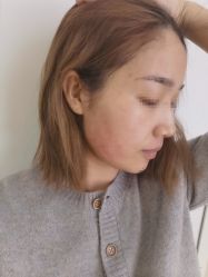 -北京爱育华医院-医疗美容科