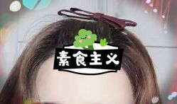 -大麦微针植发全国连锁