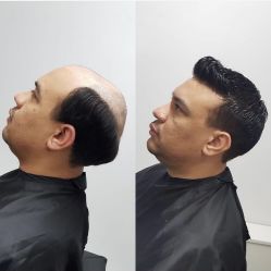 -发饰美男士增发补发假发定制店
