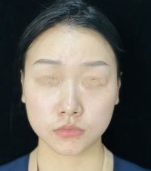 -洁铭新加坡医美