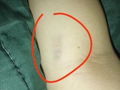 -广州仁爱天河医院体检中心