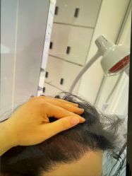 -大麦微针植发丨全国连锁