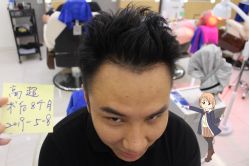 -大麦微针植发丨全国连锁