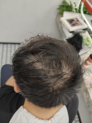 -唐风采假发补发定制