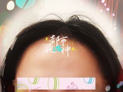 -大麦微针植发全国连锁