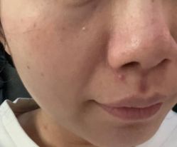 体验后-深圳阳光医疗美容医院·旗舰店