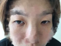 -美丽人生祛斑扁平疣汗管瘤中心