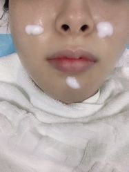 -痘博士广州·全国连锁祛痘机构