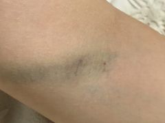 -四川省人民医院(本部)