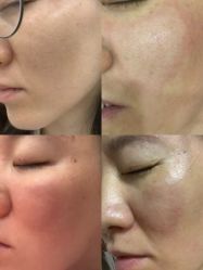 体验前-新美荟医美·专注面部美学抗衰