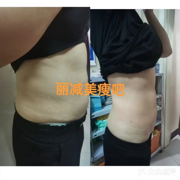 丽减美瘦吧·减肥瘦身(英达路店)图片