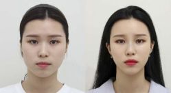 -CMS西美斯·美式医疗美容