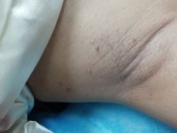 -叶美人医疗美容
