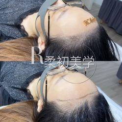-RC半永久纹眉纹发际线