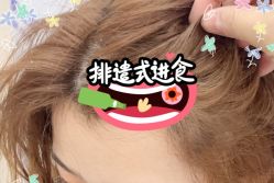 -大麦微针植发全国连锁