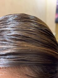 -熙朵美学植发·连锁品牌