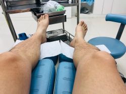 -派恩宜灰指甲鸡眼嵌甲手足癣