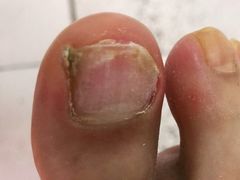 -新甲连锁灰指甲·甲沟炎·鸡眼(黑龙江路店)