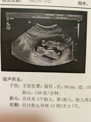 -上海美兰湖妇产科医院