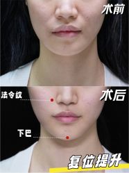 -深圳艺星医疗美容医院