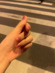 -宥莉·ULLY 痘敏肌•科技皮肤管理中心