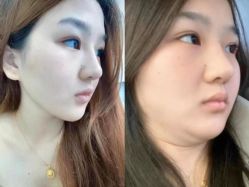 -Lily纤美·科技减脂中心