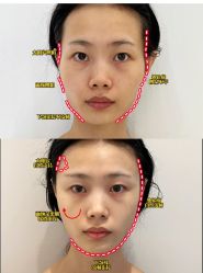 -上海伊莱美医疗美容医院