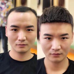 -发饰美男士增发补发假发定制店